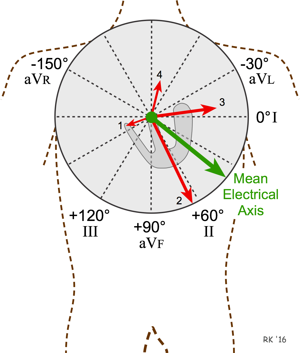 Ecg Electrical Mean Axis - Diagram (1170x1379), Png Download