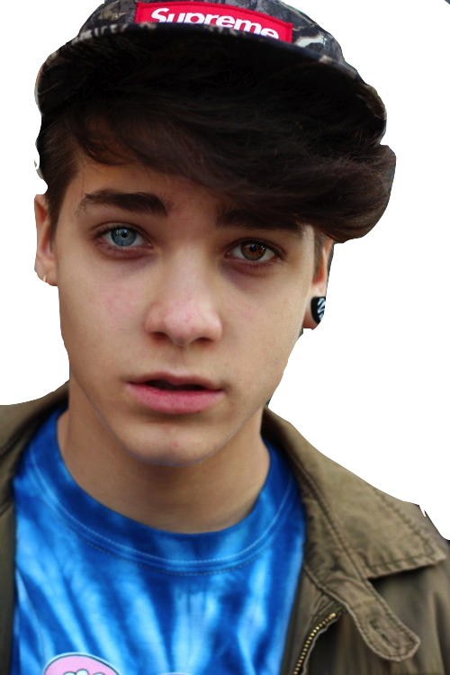 David Bowie Heterochromia - Boy With 2 Different Colored Eyes (500x750), Png Download