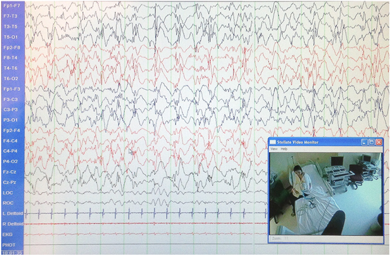Eeg - Handwriting (828x544), Png Download