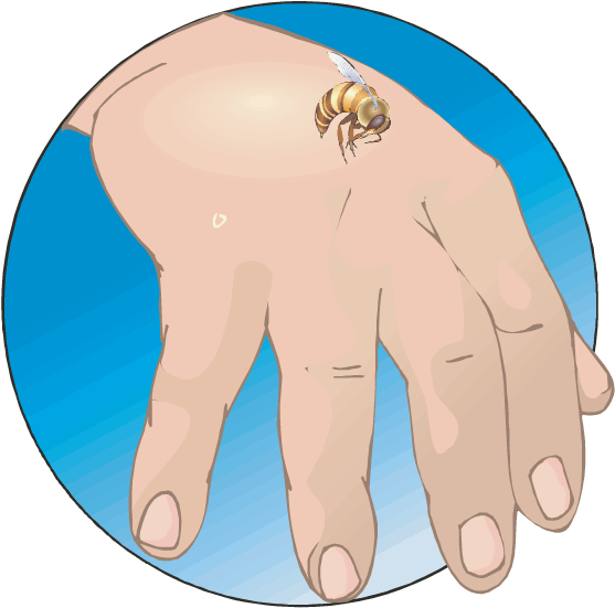 Bees Do Not Sting As An Aggressive Act - Bee Stings Allergic Reactions (612x792), Png Download