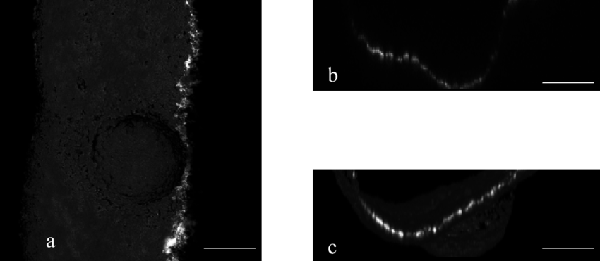 3-d Presentation Of A Laser Ablation Cavity (vsp, 28 - Radiology (850x371), Png Download