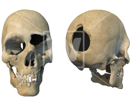 Head Shot Damaged Skulls - Skull (550x351), Png Download