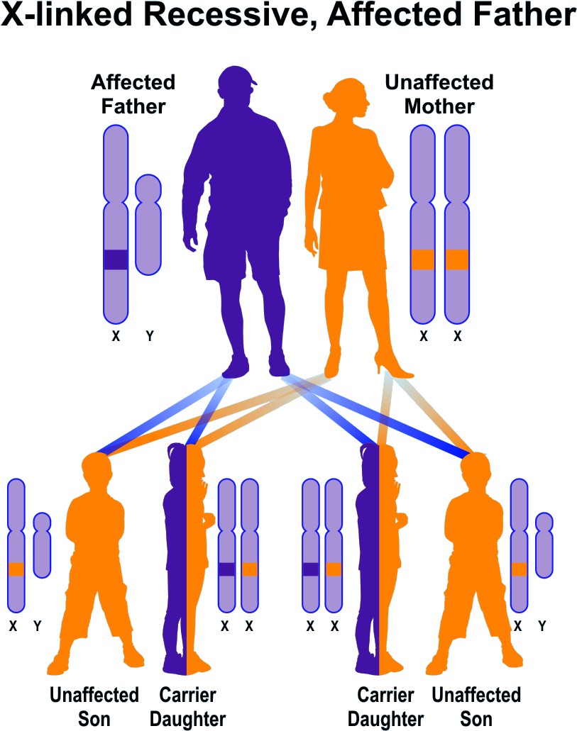 Banner Freeuse Library Ocular Type Hereditary Diseases - X Linked Recessive Father (993x1122), Png Download