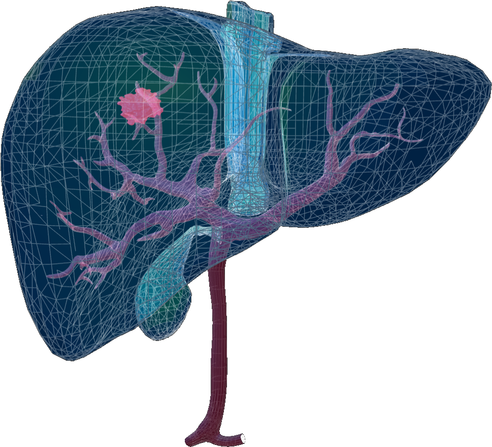 At The Global Liver Tumor Segmentation Challenge That - Butterfly (1920x1080), Png Download
