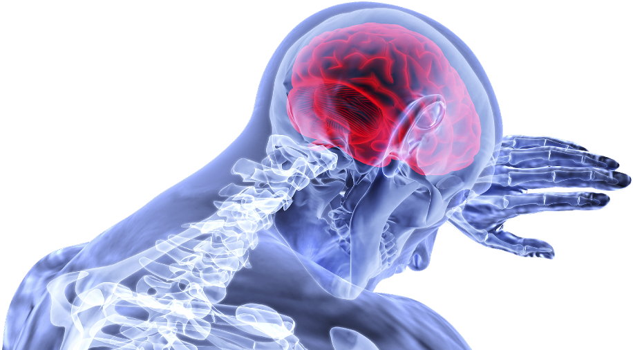 Concussion Brain Png (1000x523), Png Download