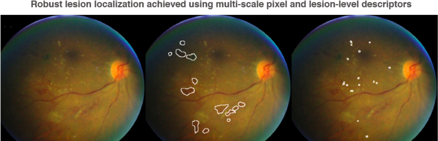 Deep Learning In Ophthalmology How Google Did It - Earth (1600x480), Png Download