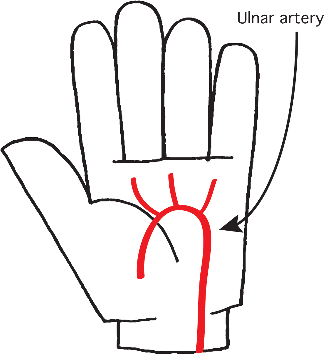 Hand (1104x1154), Png Download