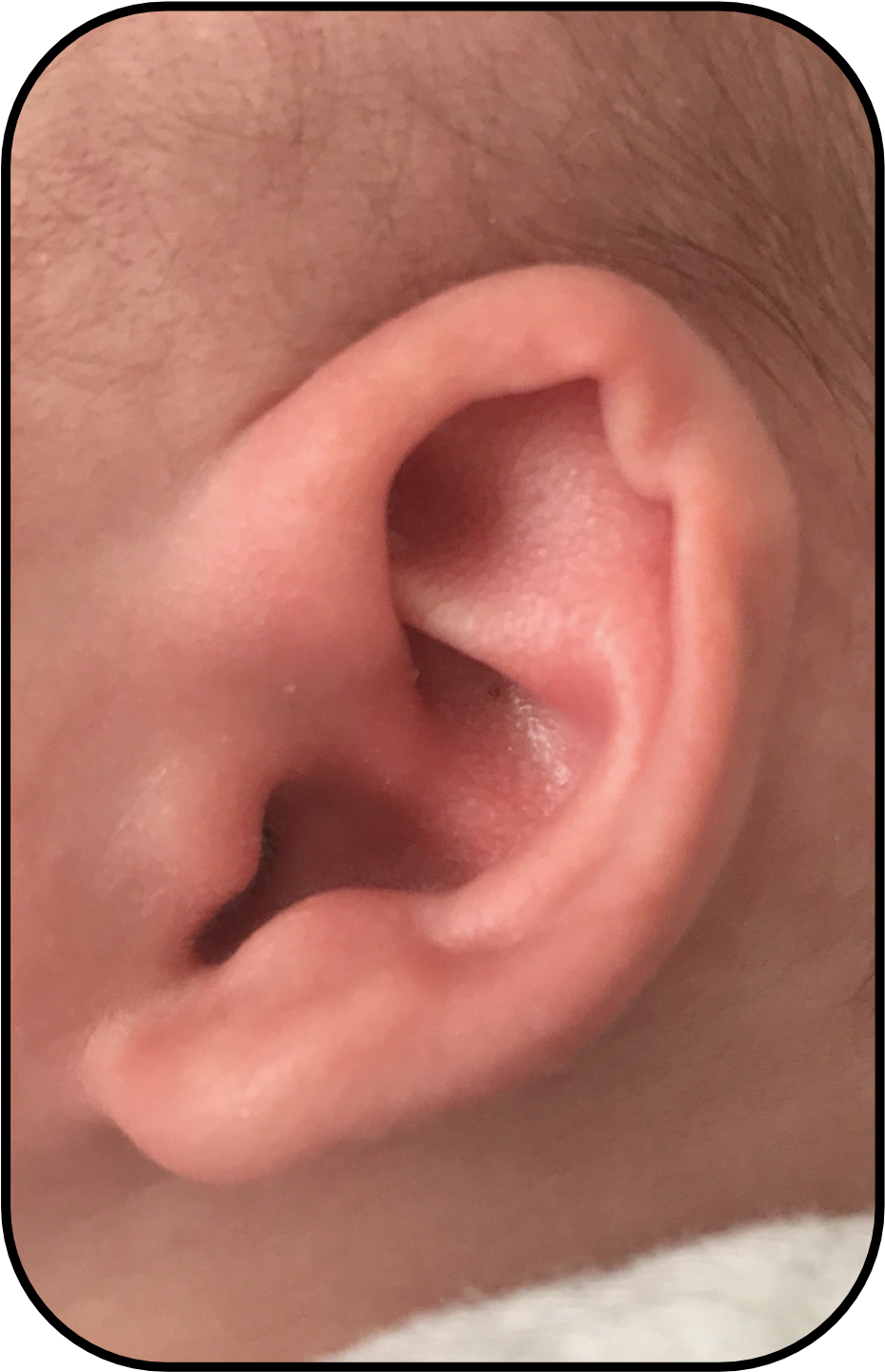 Corrected Baby Ear Usa Parent Story (1050x1470), Png Download