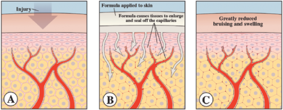 Bruise Repair Formula - Bruises Are Formed (1000x397), Png Download