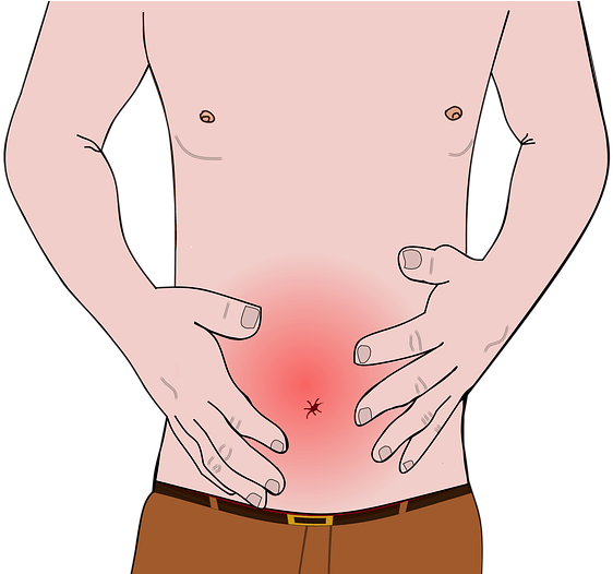 Kde Je Slepe Strevo (640x525), Png Download