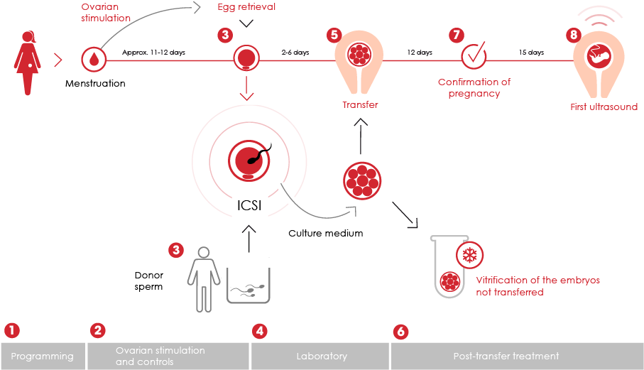 Gráfico De Fases De Fiv-icsi Con Semen De Donante - Fécondation In Vitro Icsi (945x552), Png Download