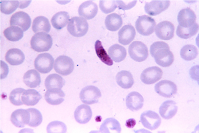 Request Pricing Info - Plasmodium Falciparum Microgametocyte (678x678), Png Download