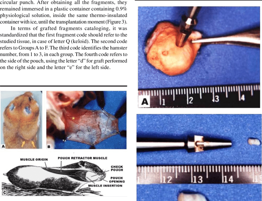 A) Hamster With Its Right Cheek - Inside A Keloid (850x654), Png Download