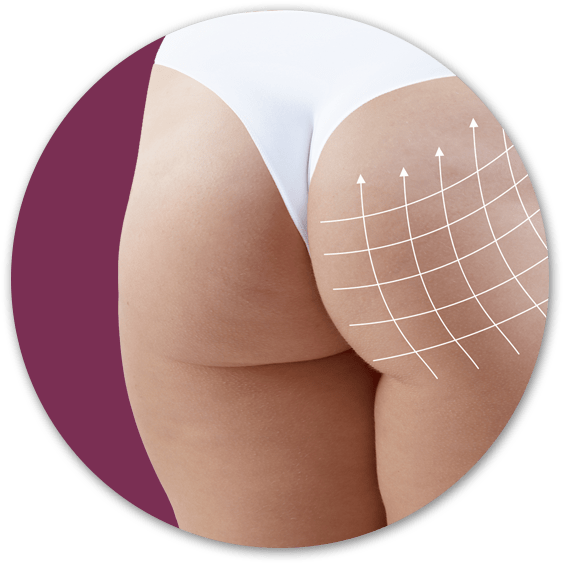 For Subtle, Safe Enhancement Of The Bum, The Non-surgical - Underpants (575x575), Png Download