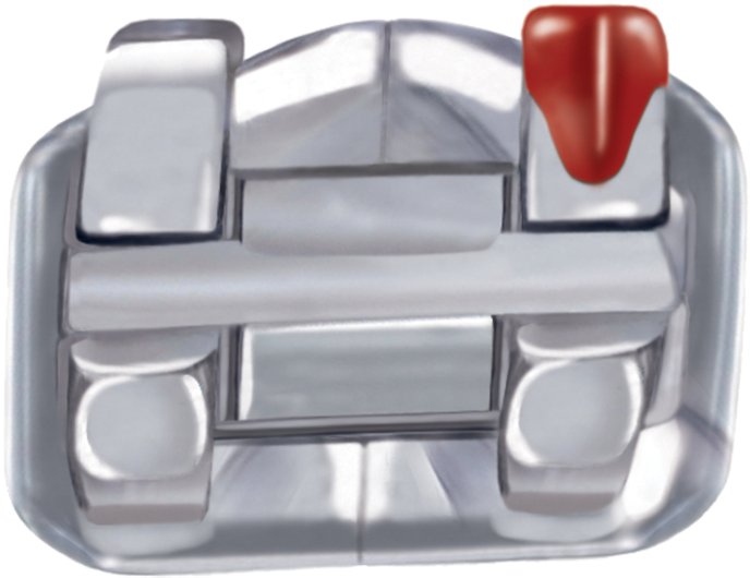 System Features - - Braquete Png (750x598), Png Download