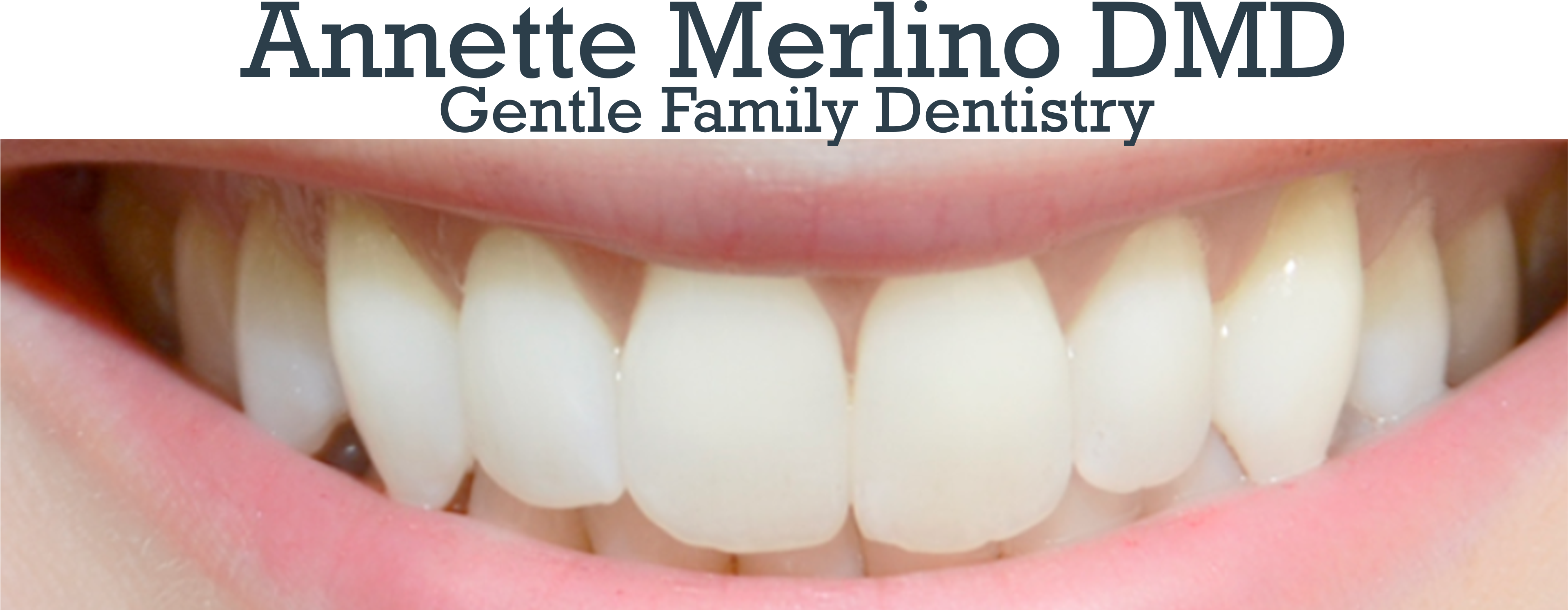 Annette Merlino, Dmd Logo - Tooth (5000x1504), Png Download