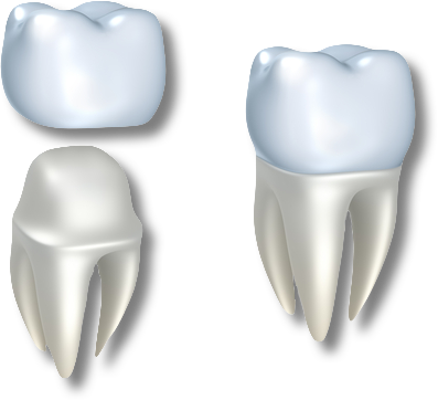 Dental Crown Transparent (397x362), Png Download