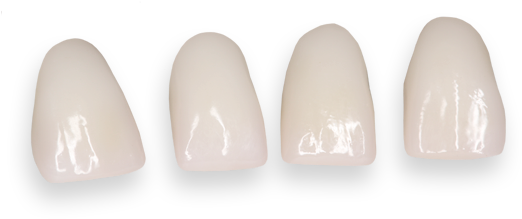 Best Dental Lab For Full Contour Zirconia Crown And - Zirconia Dental Png (574x277), Png Download