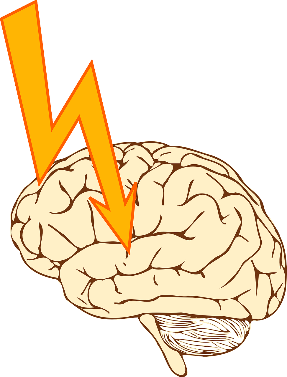 Brain Clipart Epilepsy - Stroke Clipart (973x1280), Png Download