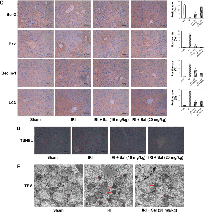Sal Pretreatment Ameliorates Apoptosis And Autophagy - Tile (850x885), Png Download