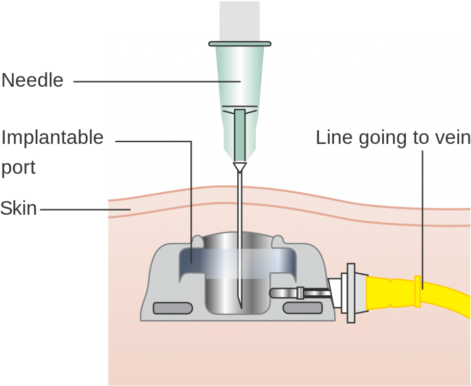 To Help Better Understand And Get A Visual Of What - Diagram (1024x857), Png Download