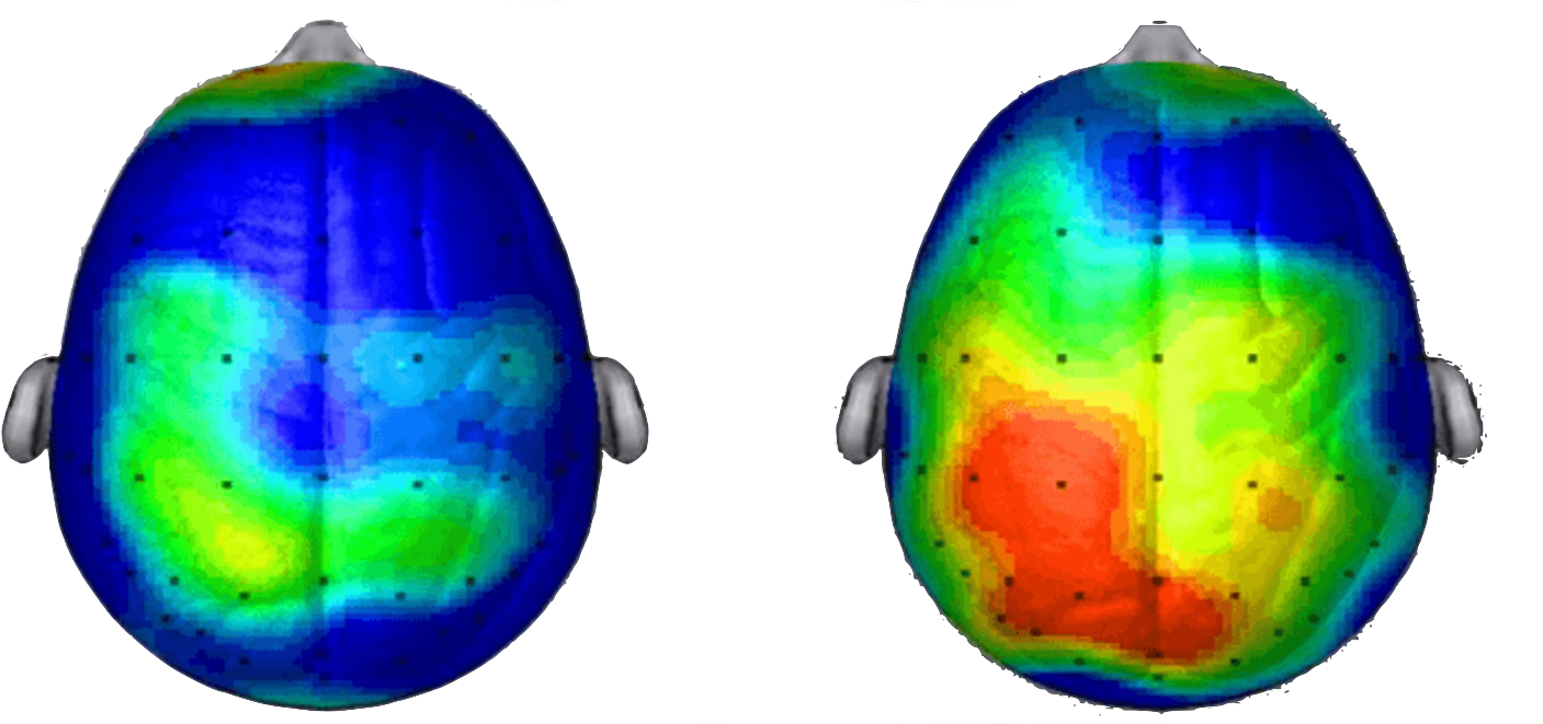 Brain Activity Energizer Ice Breaker Training - Research Scan Compliments Of Dr Chuck Hillman University (1480x660), Png Download
