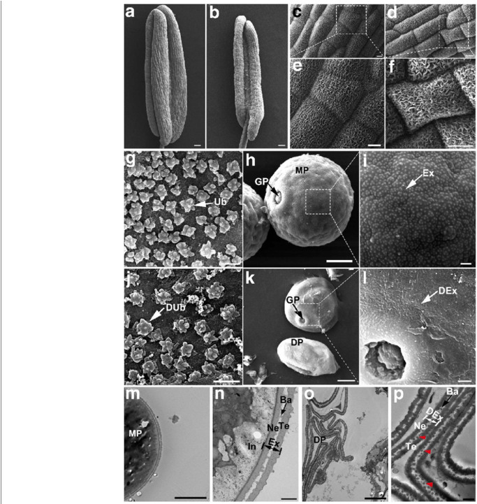 Sem And Tem Observation For The Wt And Oslap6 Anther - Monochrome (850x720), Png Download