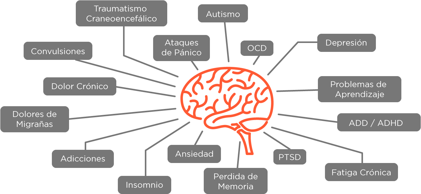 Cerebro - Diagram (1697x729), Png Download